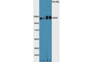 Lane 1: Mouse spleen lysate Lane 2: Mouse thymus lysate Lane 3: Mouse prostate lysate Lane 4: Mouse intestine lysate probed with Rabbit Anti-ASPP2/p53BP2 Polyclonal Antibody, Unconjugated (ABIN674394) at 1:300 overnight at 4 °C. (TP53BP2 抗体  (AA 1001-1128))