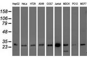 Western blot analysis of extracts (35 µg) from 9 different cell lines by using anti-OTUB2 monoclonal antibody. (OTUB2 抗体)