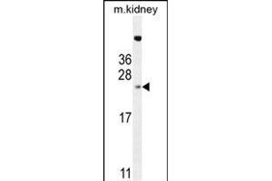 ADO Antibody (C-term) (ABIN655033 and ABIN2844665) western blot analysis in mouse kidney tissue lysates (35 μg/lane). (ADO 抗体  (C-Term))