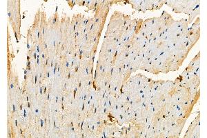 ABIN6257390 and ABIN6273800 at 1/100 staining Mouse heart tissue by IHC-P.