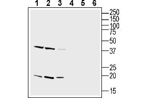 Western blot analysis of rat brain lysate (lanes 1 and 4), mouse brain lysate (lanes 2 and 5) and mouse liver lysate (lanes 3 and 6):1-3. (CD81 抗体  (Extracellular))