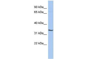 WB Suggested Anti-RNF113B Antibody Titration:  0. (RNF113B 抗体  (Middle Region))