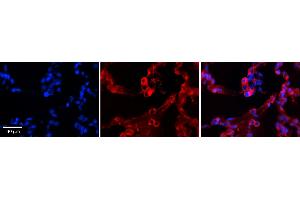 GPAA1 antibody - C-terminal region          Formalin Fixed Paraffin Embedded Tissue:  Human Lung Tissue    Observed Staining:  Cytoplasm of pneumocytes   Primary Antibody Concentration:  1:100    Other Working Concentrations:  1/600    Secondary Antibody:  Donkey anti-Rabbit-Cy3    Secondary Antibody Concentration:  1:200    Magnification:  20X    Exposure Time:  0. (GPAA1 抗体  (C-Term))