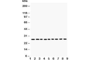 Western blot testing of Kallikrein 6 antibody and Lane 1:  MCF-7;  2: HeLa;  3: MM231;  4: MM453;  5: A549;  6: SMMC-7721;  7: COLO320;  8: SW620;  9: HT1080