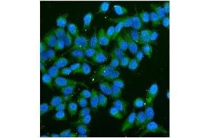 IF analysis of CD59 using anti-CD59 antibody (ABIN7600941). (CD59 抗体  (AA 26-102))