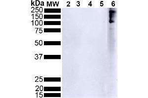 Western Blot analysis of Human Alpha Synuclein showing detection of Alpha Synuclein pSer129 protein using Rabbit Anti-Alpha Synuclein pSer129 Monoclonal Antibody, Clone J18 (ABIN6932862). (SNCA 抗体  (pSer129) (Atto 488))