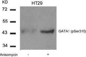 Image no. 2 for anti-GATA Binding Protein 1 (Globin Transcription Factor 1) (GATA1) (pSer310) antibody (ABIN196686) (GATA1 抗体  (pSer310))
