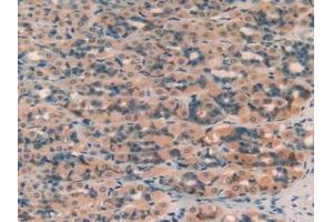 Figure. (SERPINA7 抗体  (AA 114-391))