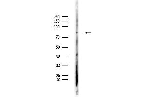 Western blot analysis of lysates from Rat brain, using SPHK2 Antibody at 1/1000 dilution.
