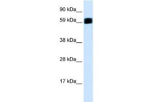 WB Suggested Anti-EIF2AK2 Antibody Titration:  0. (EIF2AK2 抗体  (C-Term))