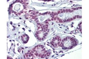 SOX4 antibody was used for immunohistochemistry at a concentration of 4-8 ug/ml. (SOX4 抗体  (N-Term))