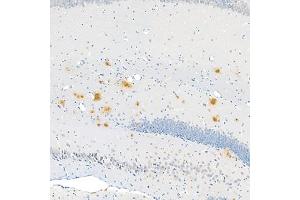 Immunohistochemistry analysis of paraffin embedded mouse Alzheimer',s brain using Aβ40 (ABIN7073042) at dilution of 1:400 (180x lens) (Abeta 1-40 抗体)