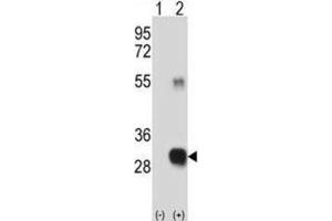 Western Blotting (WB) image for anti-CAAX Prenyl Protease 2 (RCE1) antibody (ABIN3001522) (RCE1/FACE2 抗体)
