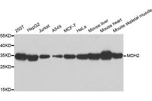 Western blot analysis of extracts of various cell lines, using MDH2 antibody. (MDH2 抗体)