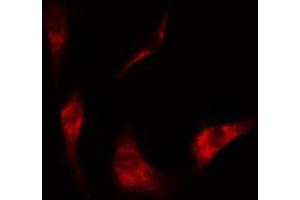 ABIN6274506 staining Hela cells by IF/ICC. (NT5C3 抗体  (N-Term))