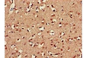 Immunohistochemistry of paraffin-embedded human brain tissue using ABIN7161085 at dilution of 1:100 (CD94 抗体  (AA 42-168))