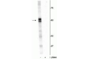 Western blot of Drosophila lysate showing specific immunolabeling of the ~60 kDa PRAS40 protein phosphorylated at Thr356 in the first lane (-). (PRAS40 抗体  (pThr356))