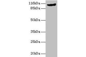 Western blot All lanes: MVP antibody at 2 μg/mL + Rat lung tissue Secondary Goat polyclonal to rabbit IgG at 1/10000 dilution Predicted band size: 100 kDa Observed band size: 110 kDa