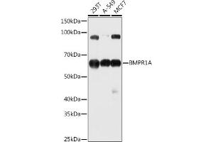 Western blot analysis of extracts of various cell lines, using BMPR1A antibody (ABIN3022599, ABIN3022600, ABIN3022601 and ABIN6218934) at 1:1000 dilution. (BMPR1A 抗体  (AA 24-200))