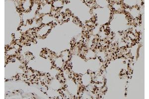 ABIN6275833 at 1/100 staining Rat lung tissue by IHC-P. (BAG4 抗体  (Internal Region))