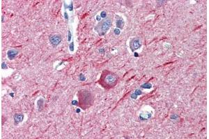 Anti-Alpha Tubulin antibody IHC staining of human brain, cortex. (alpha Tubulin 抗体  (Subunit alpha))