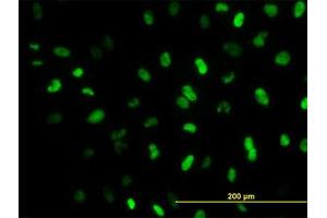 Image no. 5 for anti-Meis Homeobox 2 (MEIS2) (AA 1-382) antibody (ABIN598810) (MEIS2 抗体  (AA 1-382))