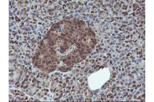 Image no. 1 for anti-Haloacid Dehalogenase-Like Hydrolase Domain Containing 1 (HDHD1) antibody (ABIN1498623) (HDHD1 抗体)