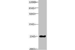 All lanes: Mouse anti-Human Timp1 monoclonal antibody at 1 μg/mL Lane 1: TIMP1 transfected pichia Yeast cell lysate Predicted band size : 23 kDa Observed band size:23 kDa (TIMP1 抗体)