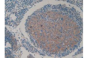 DAB staining on IHC-P; Samples: Mouse Ovary Tissue (HAP1 抗体  (AA 132-328))