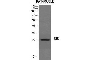 Western Blot (WB) analysis of specific cells using BID Polyclonal Antibody. (BID 抗体  (Ser179))