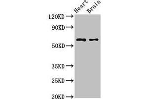 Western Blot Positive WB detected in: Mouse heart tissue, Mouse brain tissue All lanes: CYP3A4 antibody at 2. (CYP3A4 抗体  (AA 259-441))