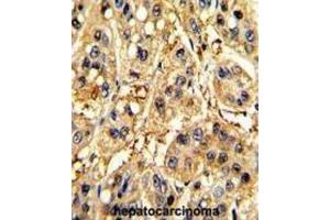 Immunohistochemistry (IHC) image for anti-Secreted Frizzled-Related Protein 5 (SFRP5) antibody (ABIN3002916) (SFRP5 抗体)