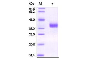 Biotinylated Human EpCAM on SDS-PAGE under reducing (R) condition. (EpCAM Protein (AA 24-265) (His tag,Biotin))