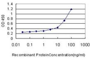 Detection limit for recombinant GST tagged UROD is approximately 1ng/ml as a capture antibody. (UROD 抗体  (AA 268-367))