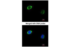 ICC/IF Image Immunofluorescence analysis of paraformaldehyde-fixed HeLa, using RAB2B, antibody at 1:200 dilution. (RAB2B 抗体)