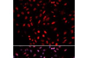 Immunofluorescence analysis of U2OS cells using POLD1 Polyclonal Antibody (POLD1 抗体)