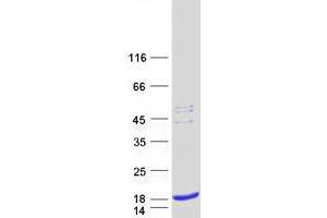Western Blotting (WB) image for Signal Peptidase Complex Subunit 1 (SPCS1) protein (Myc-DYKDDDDK Tag) (ABIN2732540)