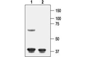 Western blot analysis of rat cortex lysate:1. (Potassium Inwardly-Rectifying Channel, Subfamily J, Member 8 (KCNJ8) Peptide)