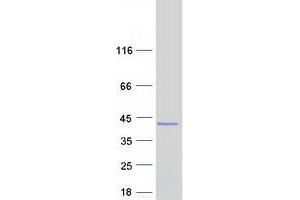 Western Blotting (WB) image for Aspartoacylase (ASPA) (Transcript Variant 1) protein (Myc-DYKDDDDK Tag) (ABIN2714658)
