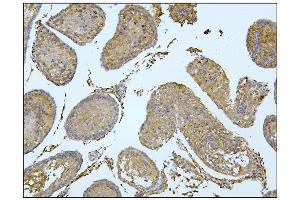 IHC analysis of BubR1/BUB1B using anti-BubR1/BUB1B antibody (ABIN7600962). (BUB1B 抗体  (AA 26-448))