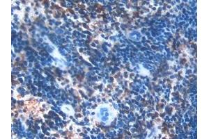 Immunohistochemistry (IHC) image for anti-Plastin 3 (PLS3) (AA 5-251) antibody (ABIN7439222)