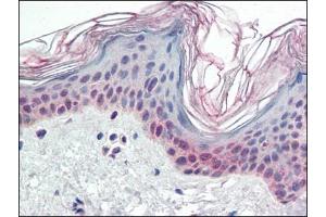 Human Skin (formalin-fixed, paraffin-embedded) stained with PARP2at 2. (PARP2 抗体  (Internal Region))
