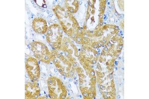 Immunohistochemistry of paraffin-embedded mouse kidney using  antibody (ABIN7265428) at dilution of 1:100 (40x lens). (ACOT2 抗体  (AA 222-483))
