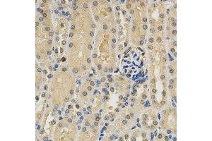 Immunohistochemistry (IHC) image for anti-Platelet Derived Growth Factor Receptor beta (PDGFRB) (AA 887-1106) antibody (ABIN3023139)
