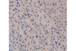 IHC-P analysis of Human Tissue, with DAB staining. (NPEPPS 抗体  (AA 584-793))