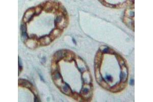 Used in DAB staining on fromalin fixed paraffin-embedded Kidney tissue (ADCY5 抗体  (AA 167-385))
