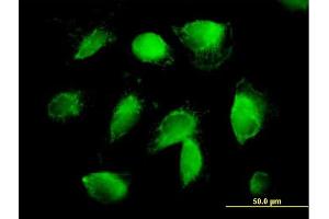 Immunofluorescence of purified MaxPab antibody to F2 on HepG2 cell. (Prothrombin 抗体  (AA 1-622))