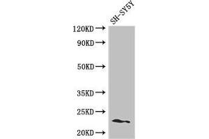 Western Blot Positive WB detected in: SH-SY5Y whole cell lysate All lanes: PEMT antibody at 2. (PEMT 抗体  (AA 2-49))