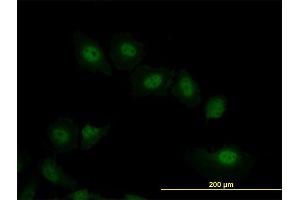 Immunofluorescence of monoclonal antibody to VRK2 on HeLa cell. (VRK2 抗体  (AA 260-360))