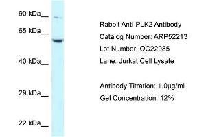 Western Blotting (WB) image for anti-Polo-Like Kinase 2 (PLK2) (Middle Region) antibody (ABIN2784827) (PLK2 抗体  (Middle Region))